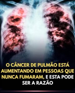 O Câncer de Pulmão Está Aumentando em Pessoas que Nunca Fumaram, e Esta Receita Pode Ser Parte da Solução