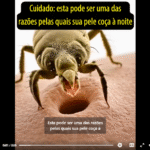 Alergia a ácaros - causas, sintomas, como tratar e eliminar ácaros Captura de tela 2026-03-27 161222