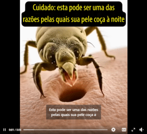 Alergia a ácaros – causas, sintomas, como tratar e eliminar ácaros
