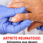 Artrite Reumatoide: Alimentos Inflamatórios e Hábitos Saudáveis 2666ee68-e528-458b-906d-57c7b7976247