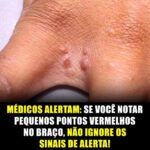 Pequenos Pontos Vermelhos no Braço: Sinais de Alerta a Não Ignorar featured-1785976020208