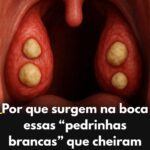 Cáseos Amigdalianos featured-1785977006850