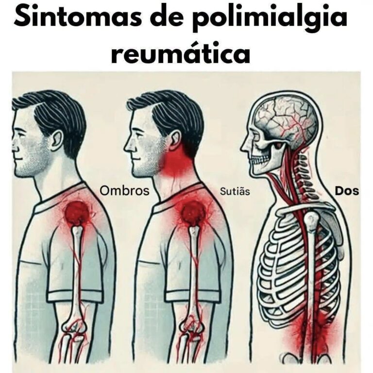 Doença comum: desvende sintomas e alivie o desconforto