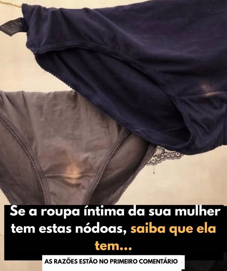 Manchas na Roupa Íntima Feminina: O Que Elas Revelam Sobre a Saúde