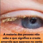 Ramela nos olhos featured-1785979453640