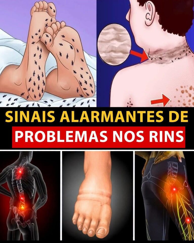 8 Sinais de Perigo nos Rins que Seu Corpo Pode Estar Enviando