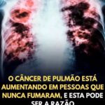 Câncer de pulmão em não fumantes: entenda os motivos preview-1789016266570