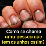 Como se chama uma pessoa que tem as unhas assim? preview-1790402756082